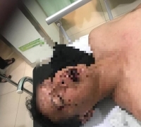 Cemburu, Anak Pejabat Pukulin Warga Pekanbaru hingga Koma