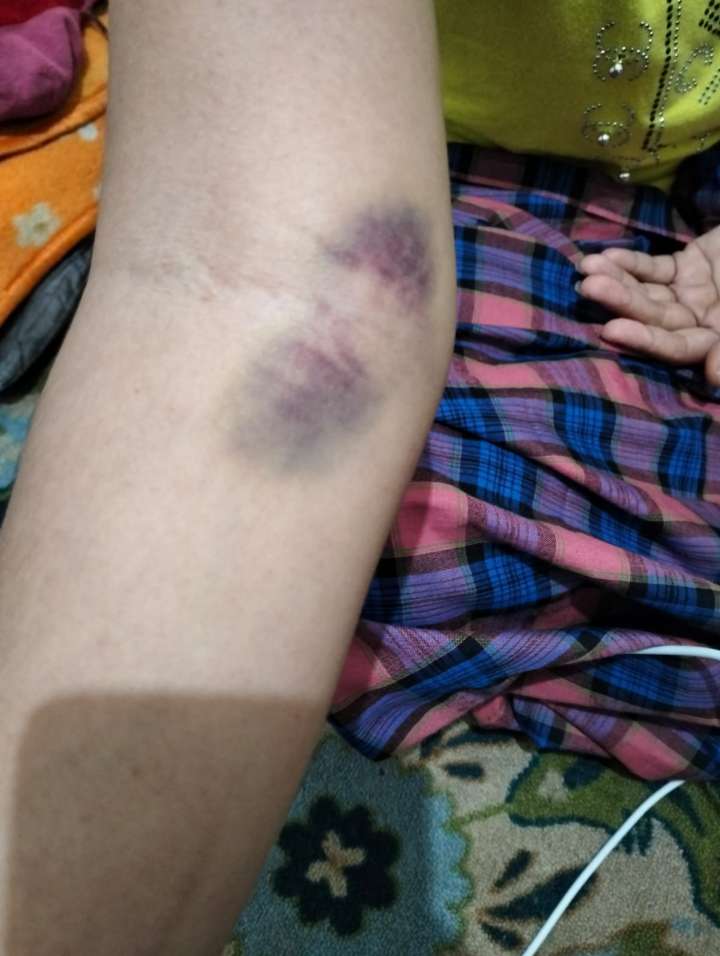 Pegawai Klinik Kasih Ibu Pangkalan Kerinci Diduga Lakukan Mal Praktik