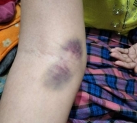 Pegawai Klinik Kasih Ibu Pangkalan Kerinci Diduga Lakukan Mal Praktik